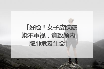 好险！女子皮肤感染不重视，竟致颅内脓肿危及生命